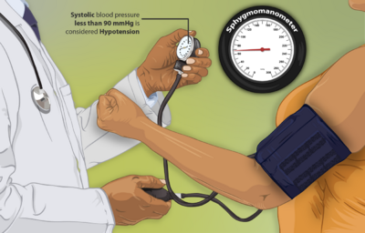 Depiction of a hypotension (low blood pressure) patient getting her blood pressure checked