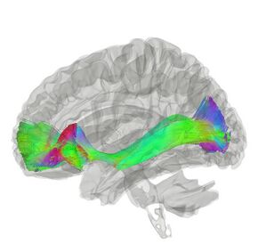 Inferior Fronto Occipital Fasciculus.jpg