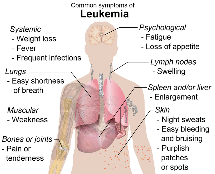 File:Symptoms of leukemia.png