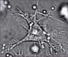 Dendritic cell.JPG