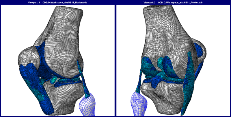 File:Human knee joint FE model.png