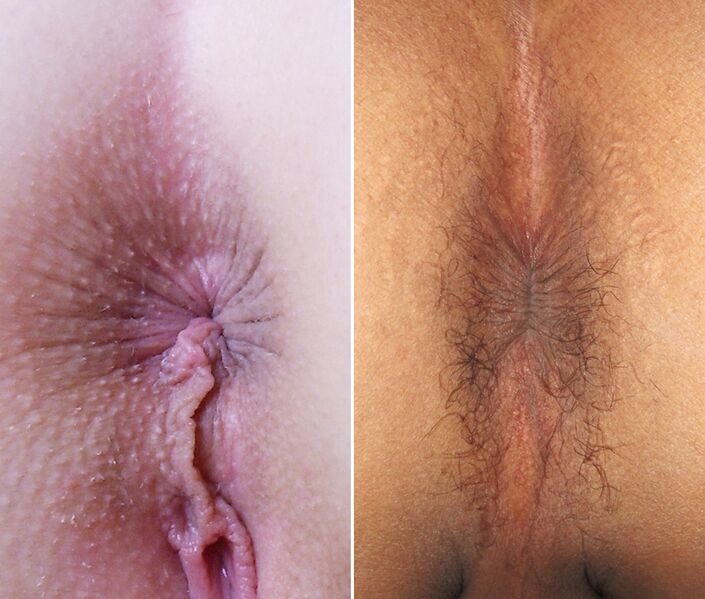 File:Female and male anus.jpg