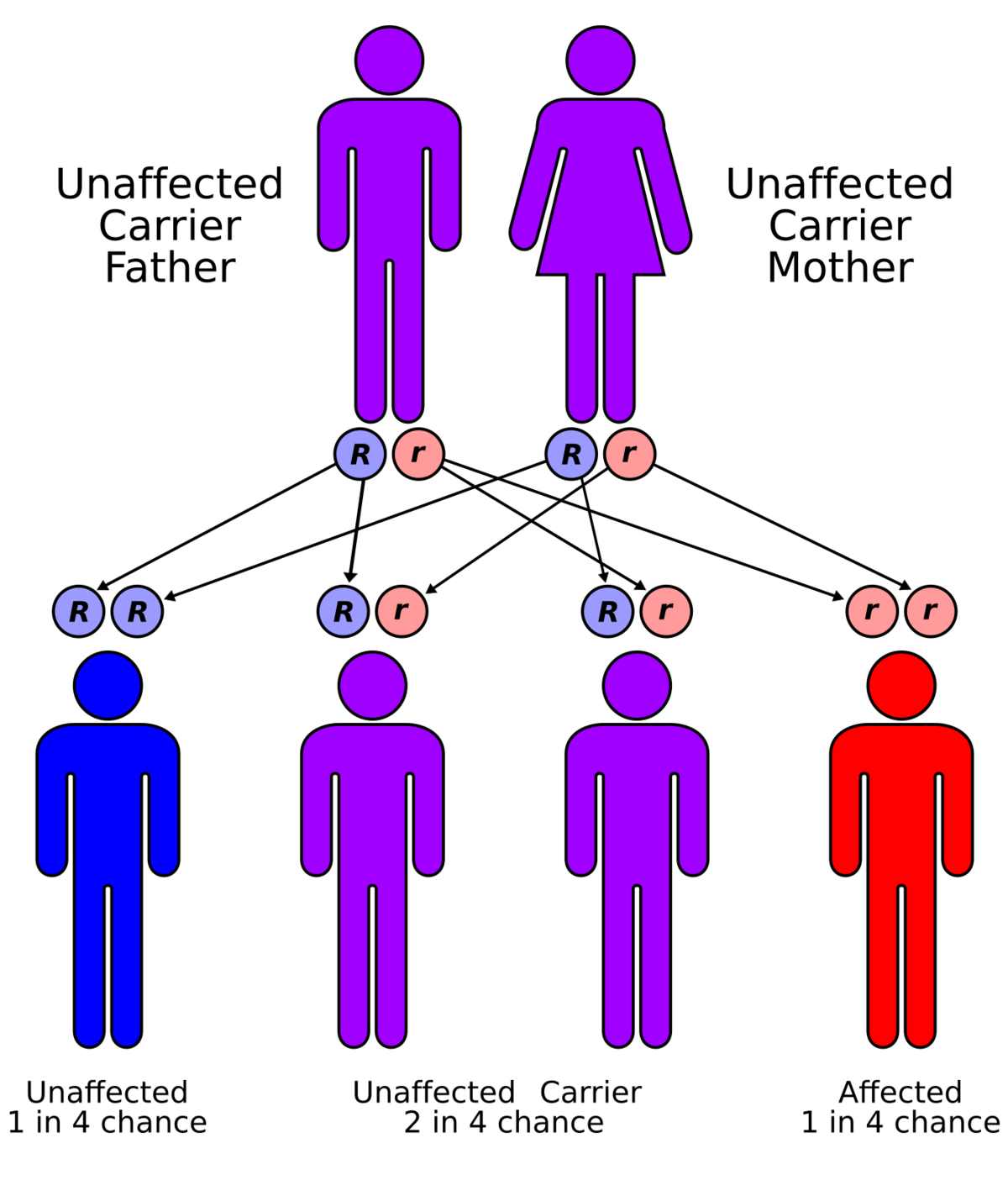 Medicine:Multiple sulfatase deficiency - HandWiki