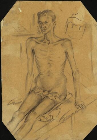 Dysentery Patient, Burma Hospital, Siam Art.IWMART1541787.jpg