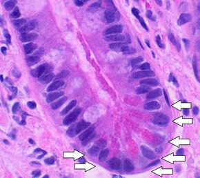 Histology of paneth cells, annotated.jpg