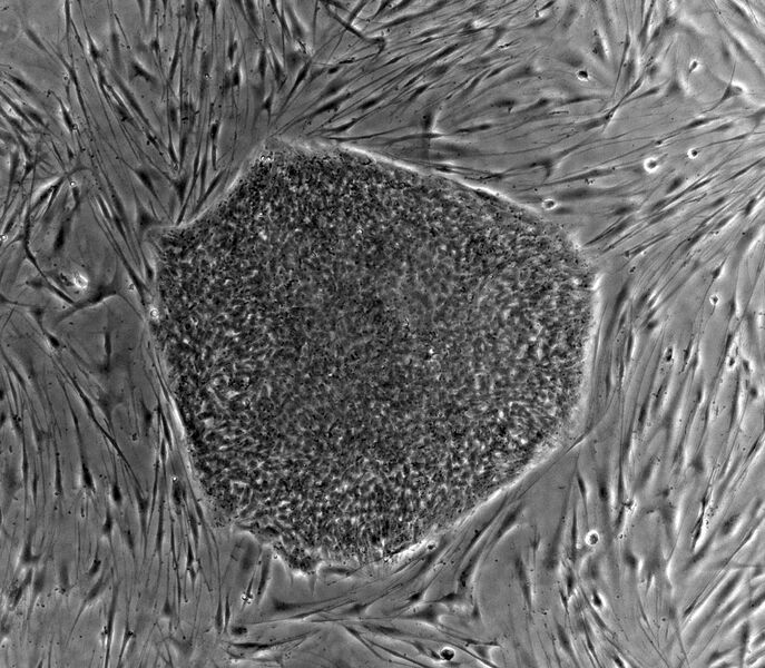 File:Human embryonic stem cell colony phase.jpg