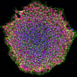 Human induced pluripotent stem cell colony (51816035910).jpg