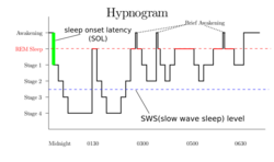 Sleep Hypnogram.svg