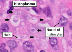 Histopathology of histoplasma, HE stain.png