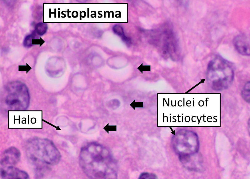 File:Histopathology of histoplasma, HE stain.png