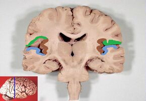Human brain frontal (coronal) section description2.JPG