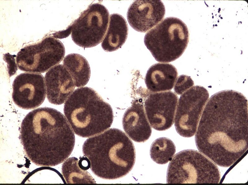 File:Ichthyophthirius multifiliis.jpg