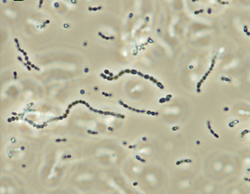 Streptococcus iniae.png