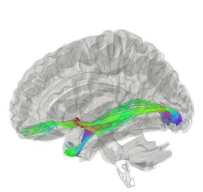 Anterior Commissure.jpg