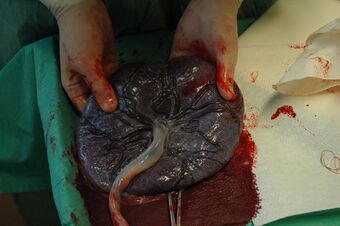 Placenta held.jpg