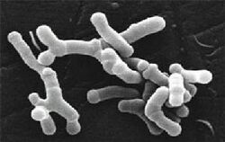Bifidobacterium longum en microscopie électronique.jpg