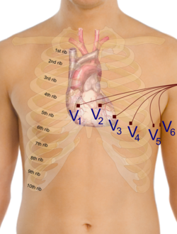 Precordial leads in ECG.png