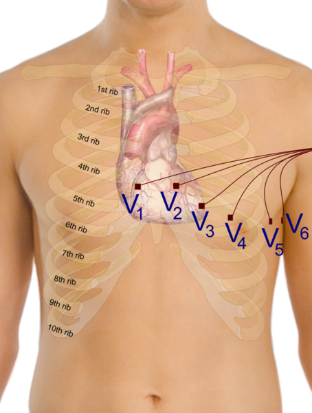 File:Precordial leads in ECG.png