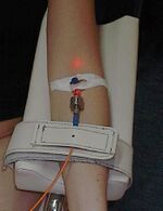 An intravenous blood irradiation therapy in use.
