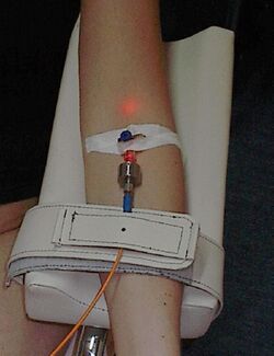 Intravenous Blood Irradiation.JPG