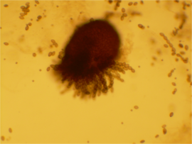 Sordaria fimicola perithecium (tan mutant) 40X.png