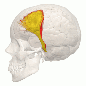 Tractography - Frontopontine tract - animation 1.gif