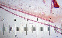"Streptobacillus" Numbered ticks are 11 µm apart