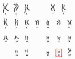Human male karyotpe high resolution - Chromosome 22.png