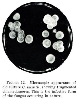 Coccidioides immitis microscopy.jpg