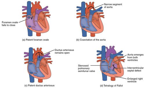 2009 Congenital Heart Defects.jpg