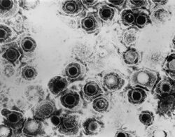 Herpes simplex virus TEM B82-0474 lores.jpg