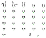 Karyotype of sheep (Ovis aries).png