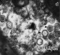 Transmission electron micrographs of H. ericinainfected by CeV-O1B.png