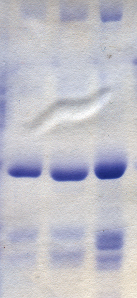 File:Coomassie blue stained gel.png