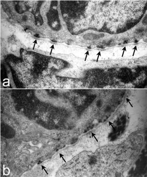 Ultrastructure of tracheal hemidesmosomes in mice.JPEG