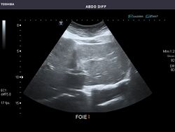 Abdominal Ultrasound Full Exam 08.jpg
