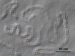 Electron micrograph of "Citrus psorosis ophiovirus"