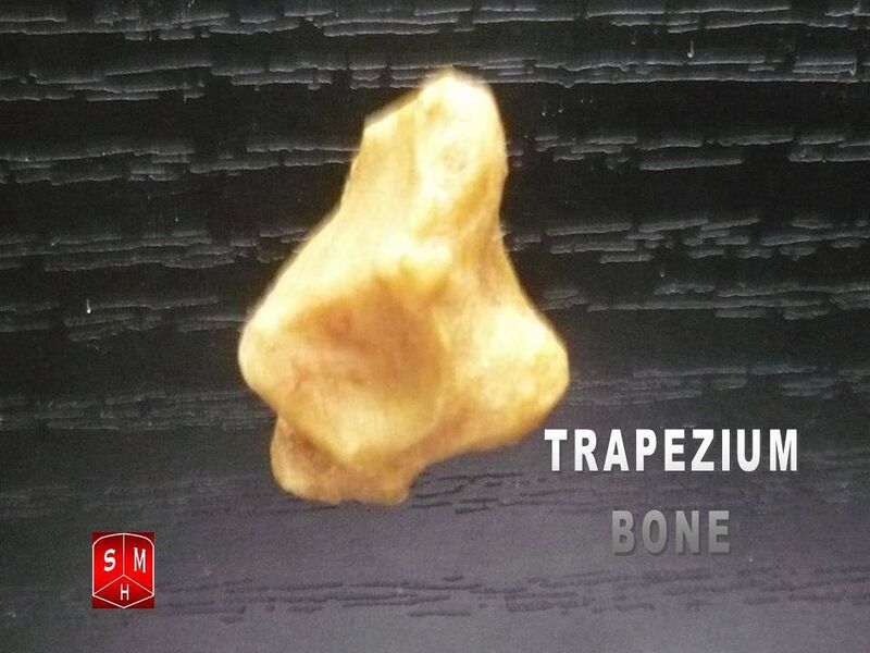 File:Trapezium bone.jpg