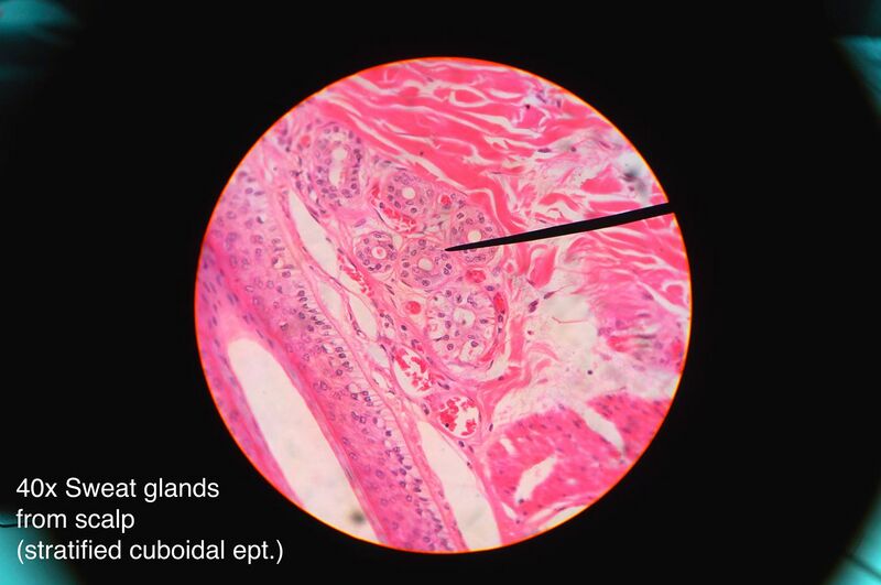 File:Sweat gland histology 2014.jpg