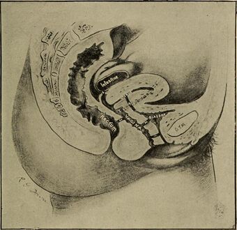 Gynecological diagnosis (1910) (14591554198).jpg