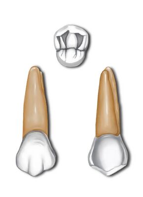 Maxillary first premolar.jpg
