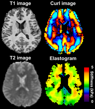 Murphy 2013 brain MRE with wave image.png