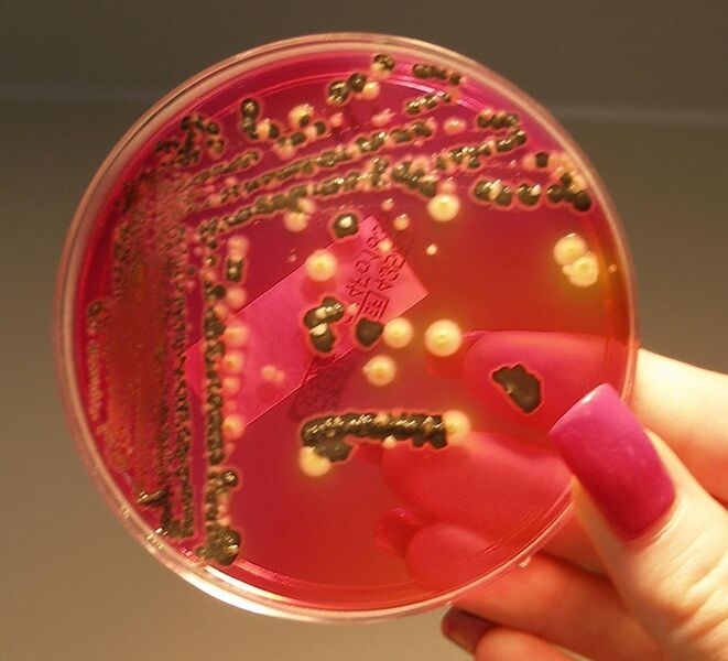 File:Salmonella growing on XLD agar.JPG