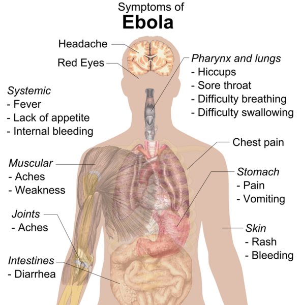 File:Symptoms of ebola.png