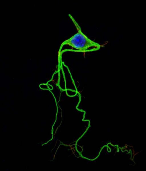 File:Neuron colored.jpg