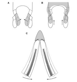 Hypotheses for jaw movement in Heterodontosaurus.jpg