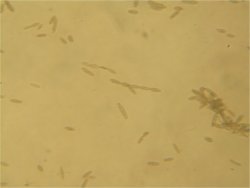 Oidium (Microsphaera) spores 160X.png