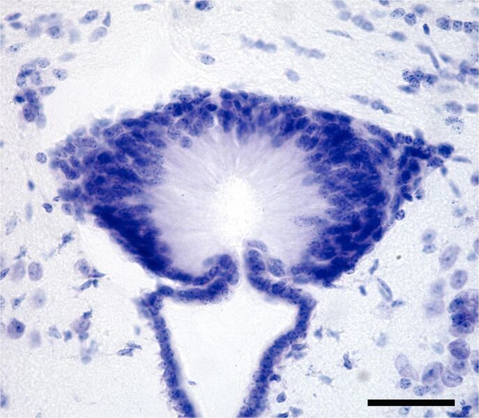 File:Subcommissural organ of the mouse brain.jpg