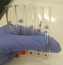 Blood typing by manual tube method - type O positive.jpg