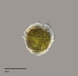 Peridinium willei - 400x - Dinoflagellate (15058894916).jpg